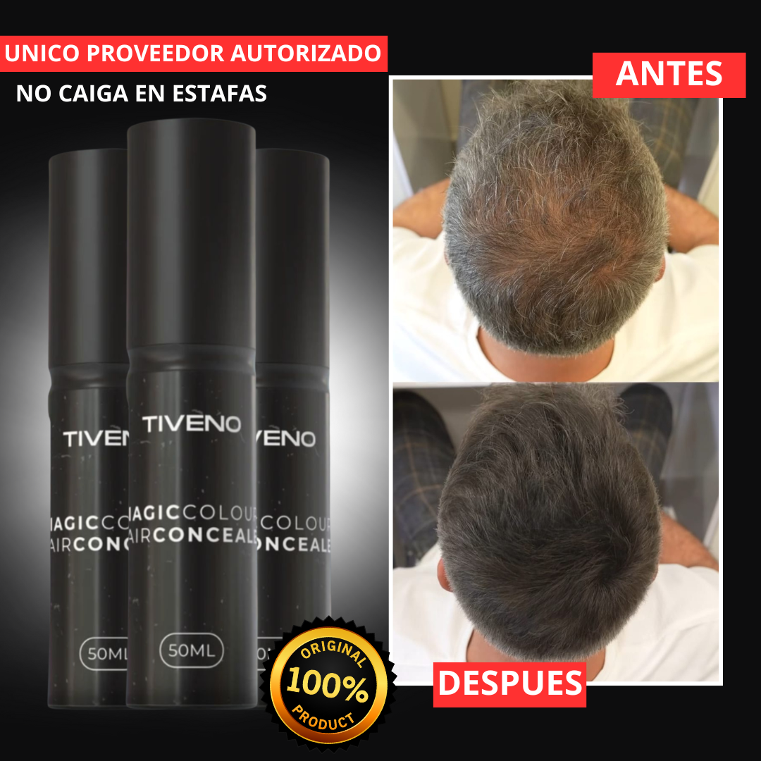 Tiveno™ - Pigmento Capilar Masculino - Efecto 7 dias (Importado)