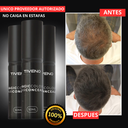 Tiveno™ - Pigmento Capilar Masculino - Efecto 7 dias (Importado)