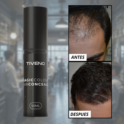 Tiveno™ - Pigmento Capilar Masculino - Efecto 7 dias (Importado)